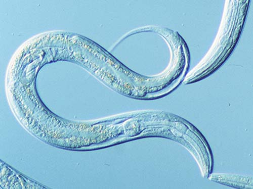 Come L’intelligenza artificiale aiuterà a scoprire le malattie genetiche