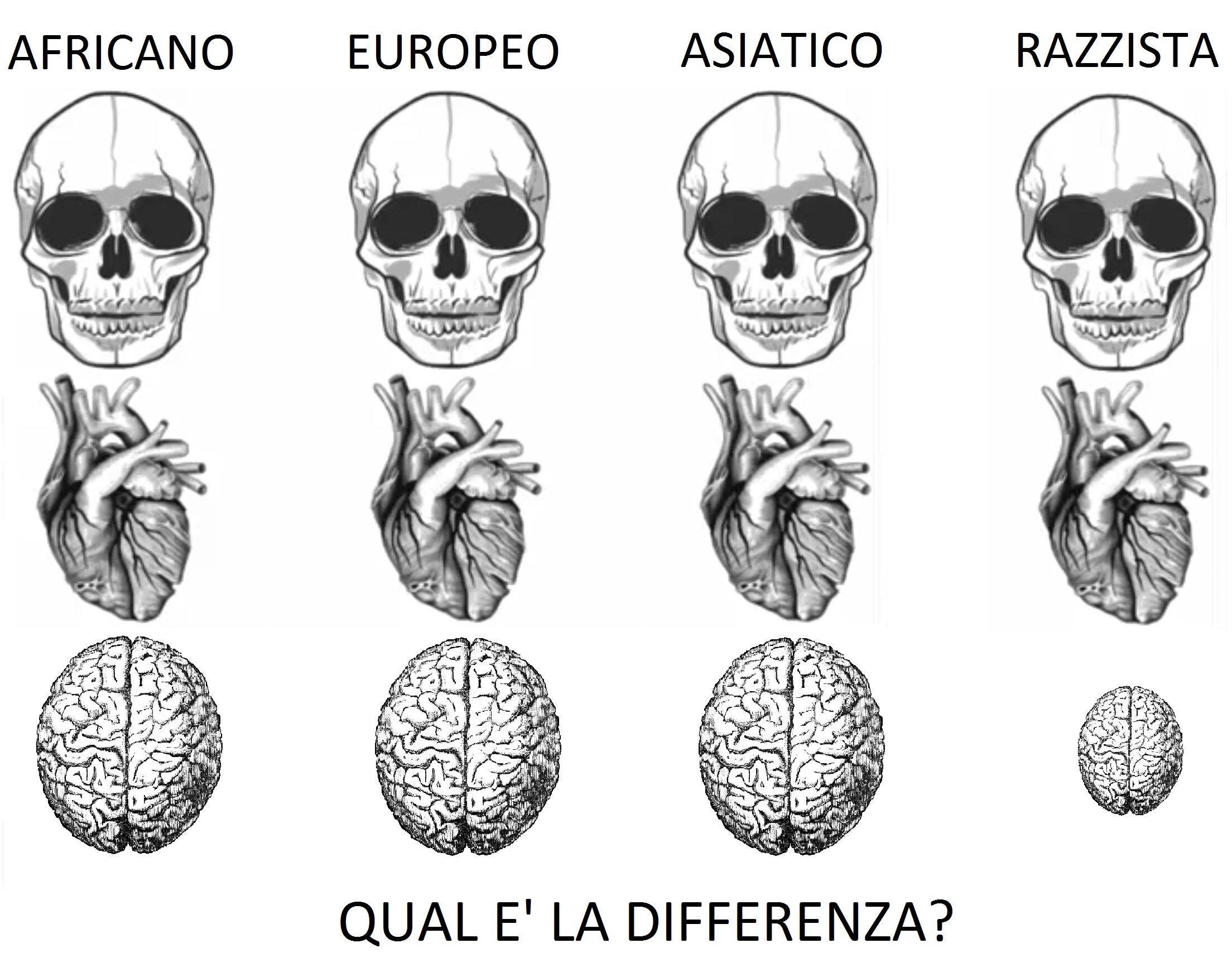 Spatatoria e razzismo