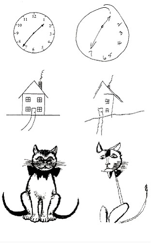 prove di un neglettico